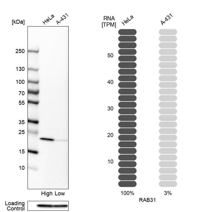 RAB31 Antibody