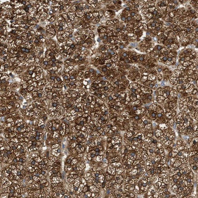 RAB31 Antibody in Immunohistochemistry (IHC)