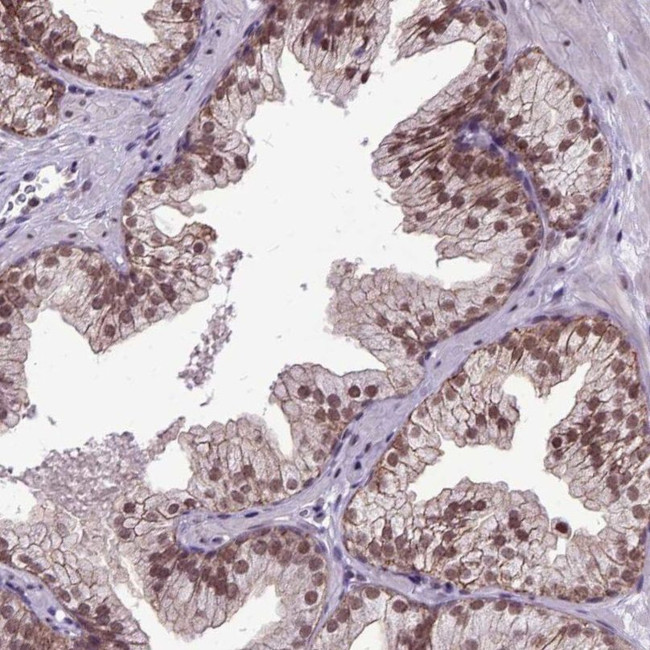 ORC5L Antibody in Immunohistochemistry (IHC)