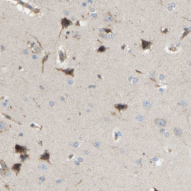 AKAP13 Antibody in Immunohistochemistry (IHC)