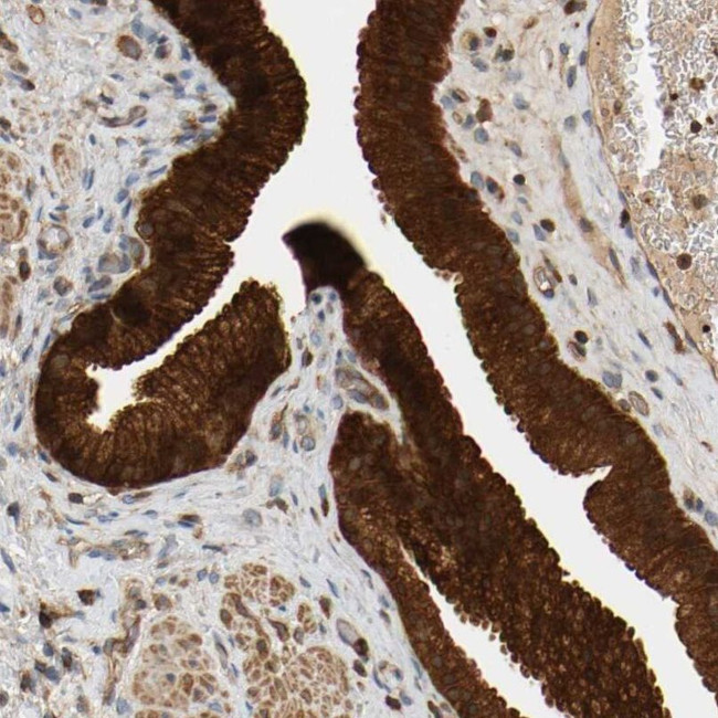 AKAP13 Antibody in Immunohistochemistry (IHC)