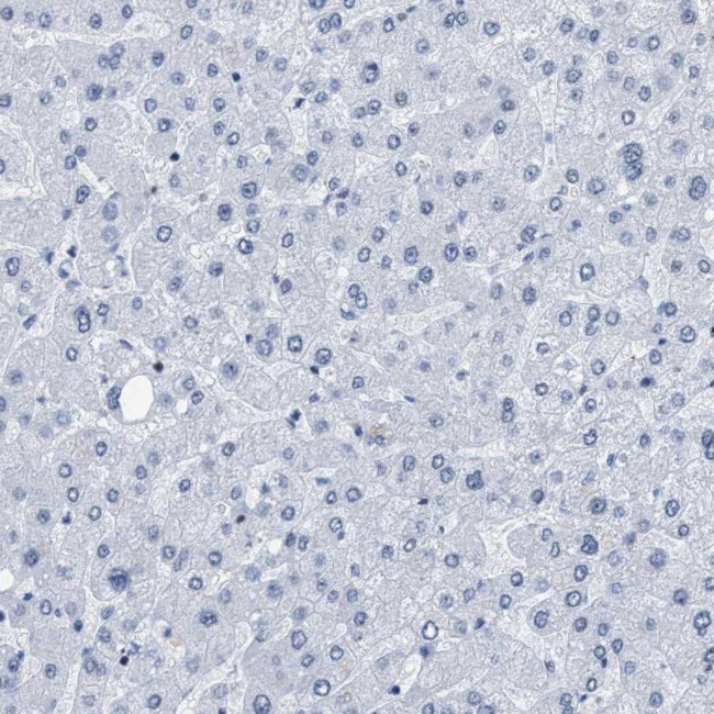 DBC1 Antibody in Immunohistochemistry (IHC)