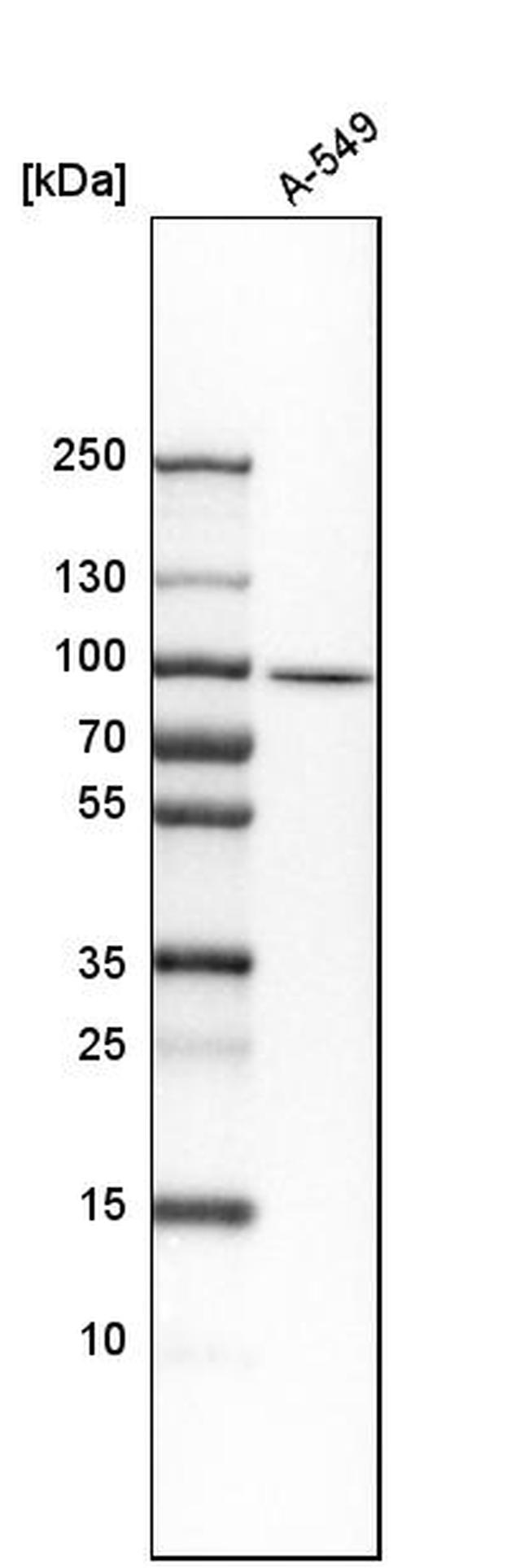 HEATR2 Antibody in Western Blot (WB)