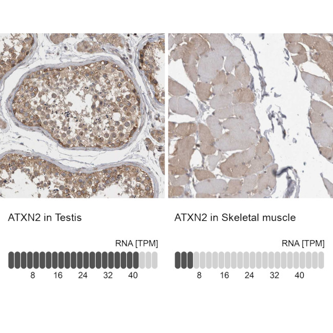 Ataxin 2 Antibody in Immunohistochemistry (IHC)