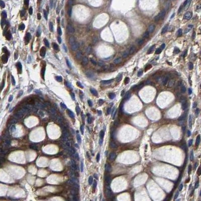 DARS Antibody in Immunohistochemistry (IHC)