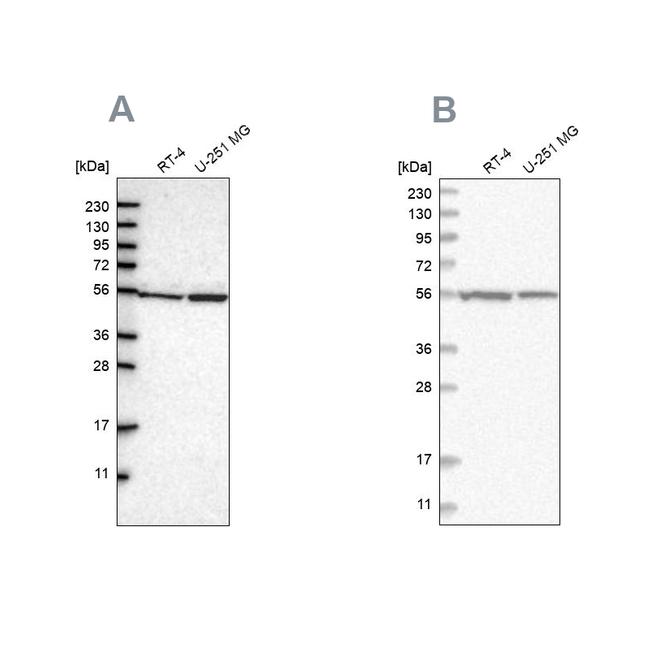 DARS Antibody in Western Blot (WB)