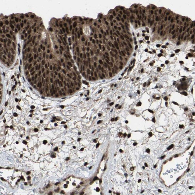 HAUS6 Antibody in Immunohistochemistry (IHC)