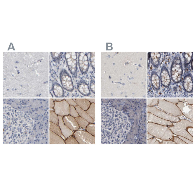 MURC Antibody in Immunohistochemistry (IHC)