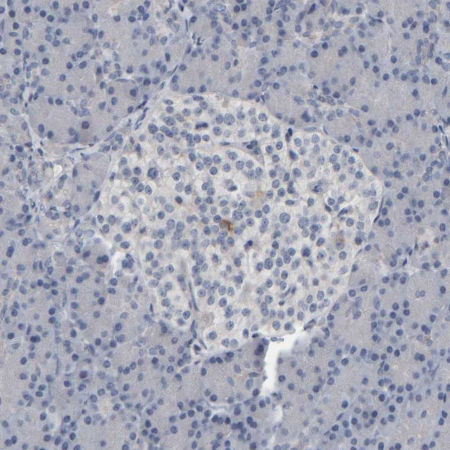 MURC Antibody in Immunohistochemistry (IHC)