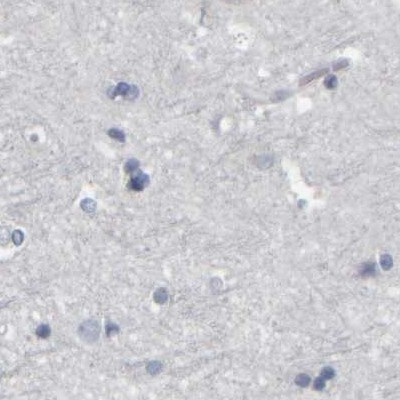 MURC Antibody in Immunohistochemistry (IHC)