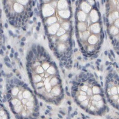 MURC Antibody in Immunohistochemistry (IHC)