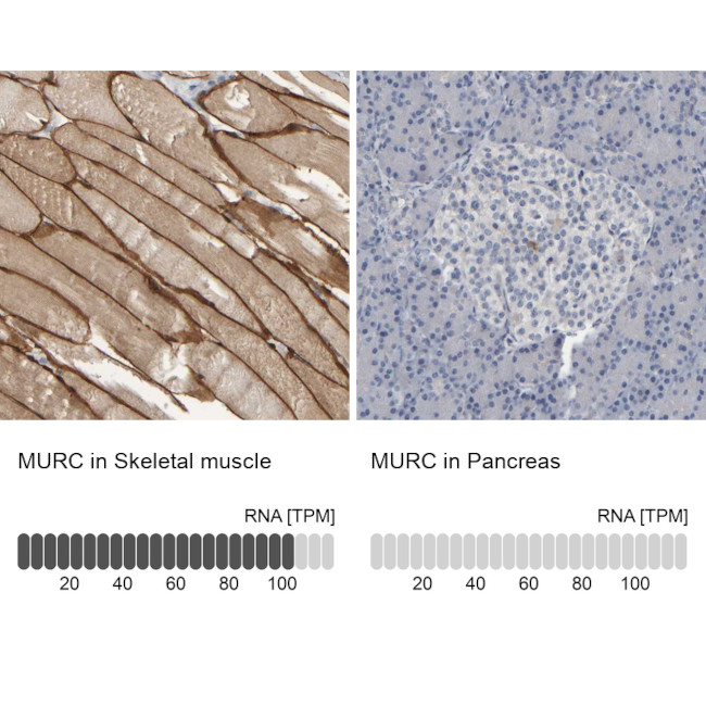 MURC Antibody