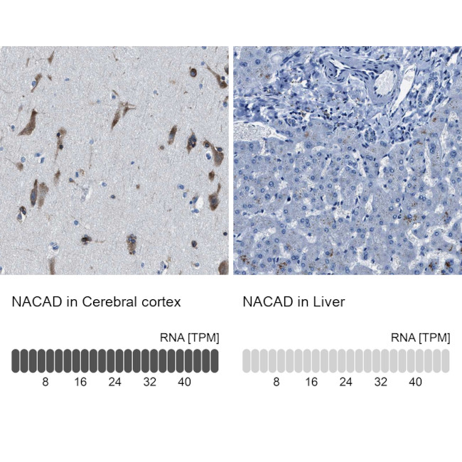 NACAD Antibody in Immunohistochemistry (IHC)