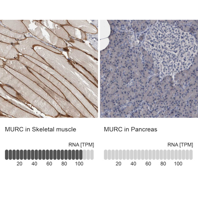 MURC Antibody in Immunohistochemistry (IHC)