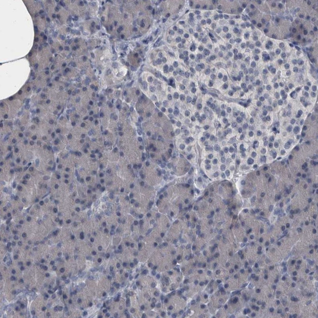 MURC Antibody in Immunohistochemistry (IHC)