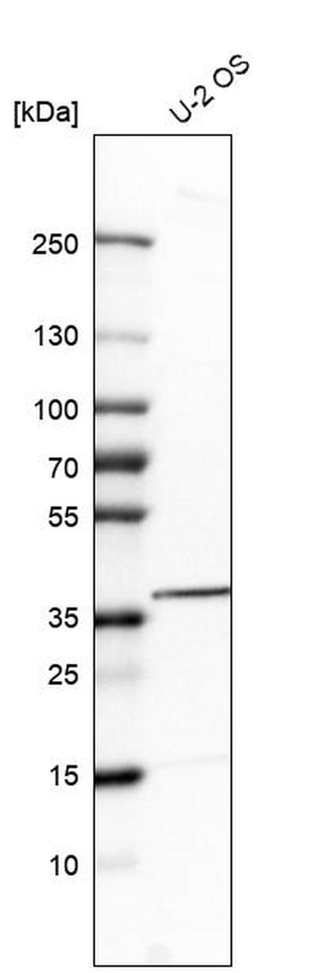 TPST2 Antibody in Western Blot (WB)