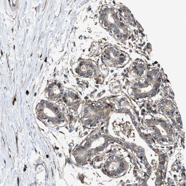 MRPS30 Antibody in Immunohistochemistry (IHC)