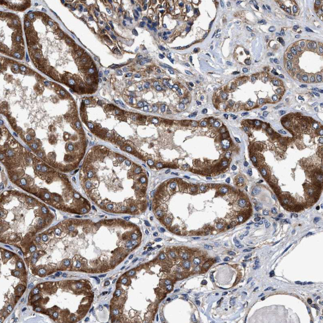 MRPS30 Antibody in Immunohistochemistry (IHC)