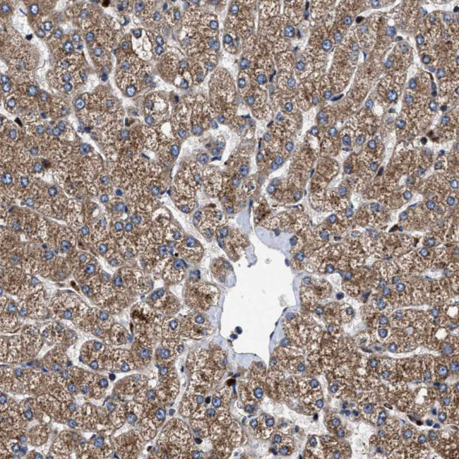 MRPS30 Antibody in Immunohistochemistry (IHC)