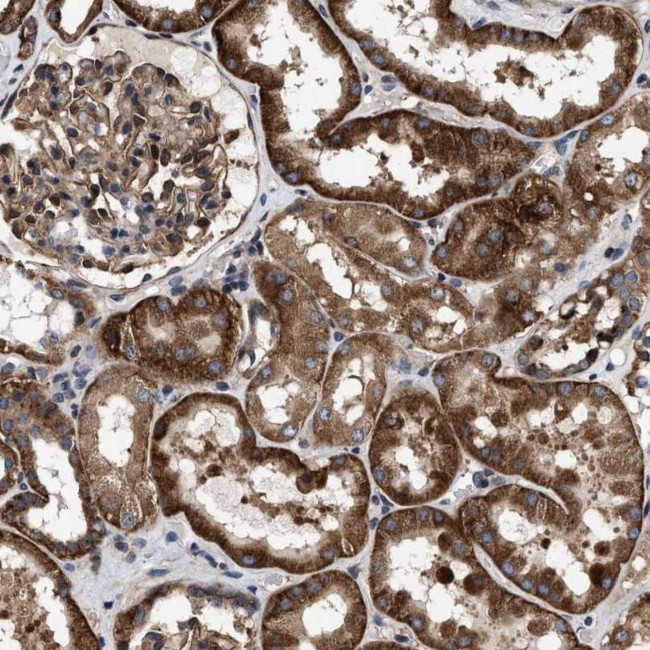 MRPS30 Antibody in Immunohistochemistry (IHC)