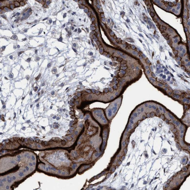 SLC43A2 Antibody in Immunohistochemistry (IHC)