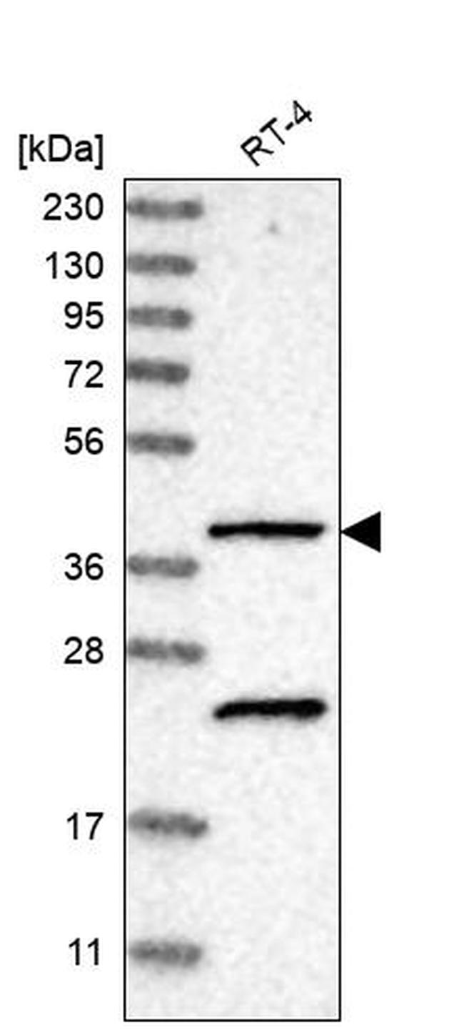 SLC43A2 Antibody in Western Blot (WB)