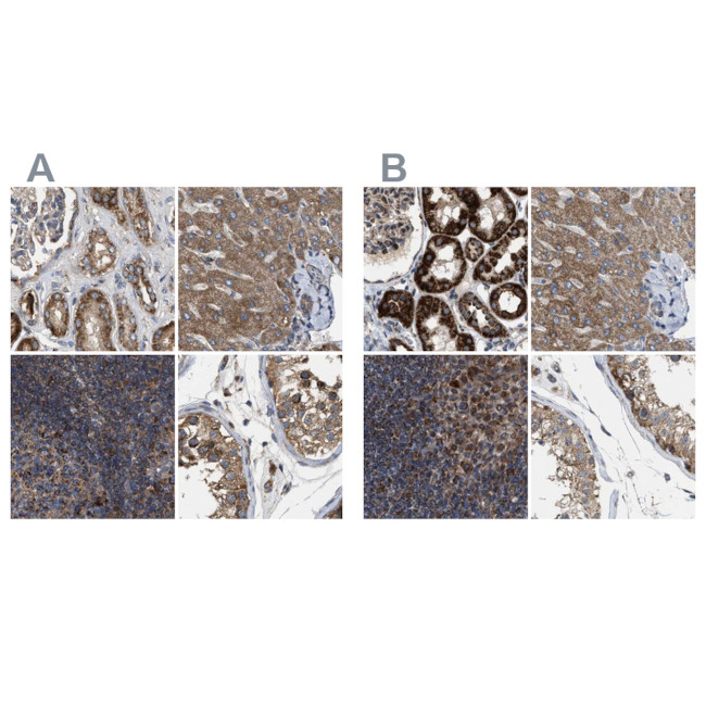 CCDC44 Antibody in Immunohistochemistry (IHC)