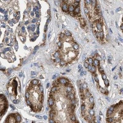 CCDC44 Antibody in Immunohistochemistry (IHC)