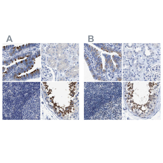 DNAI1 Antibody in Immunohistochemistry (IHC)