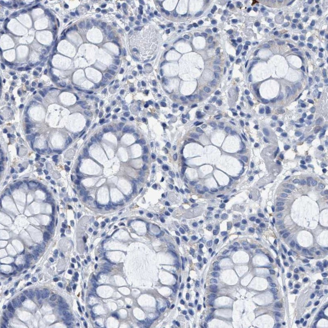 DNAI1 Antibody in Immunohistochemistry (IHC)