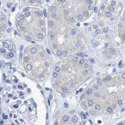 DNAI1 Antibody in Immunohistochemistry (IHC)