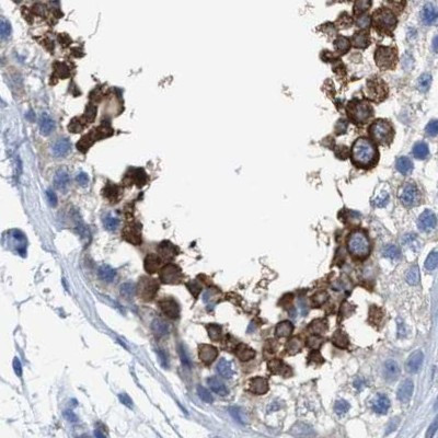 DNAI1 Antibody in Immunohistochemistry (IHC)