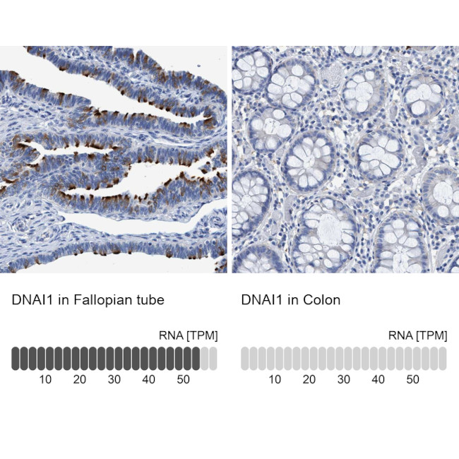 DNAI1 Antibody