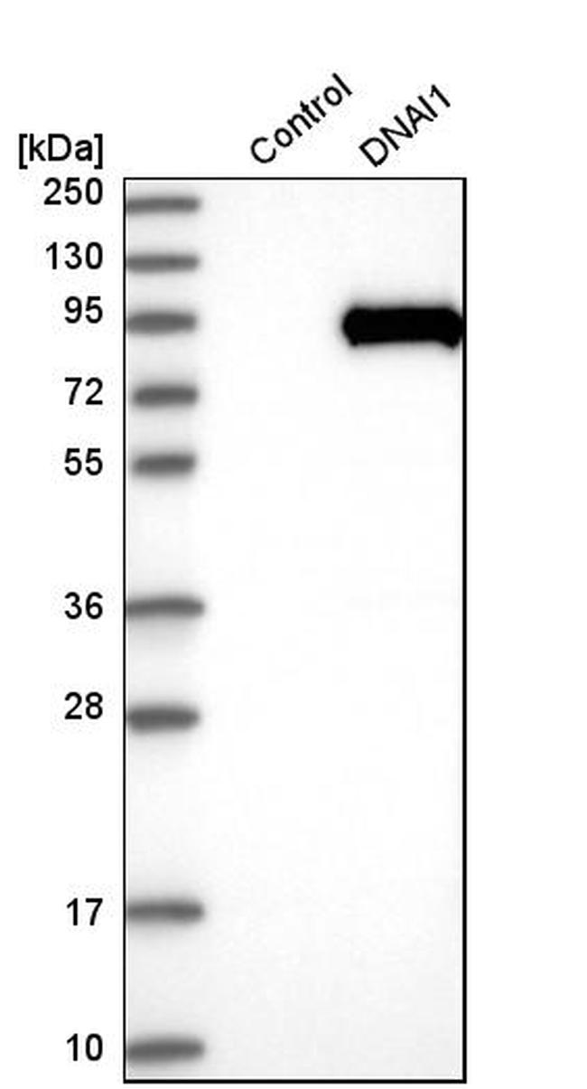 DNAI1 Antibody in Western Blot (WB)