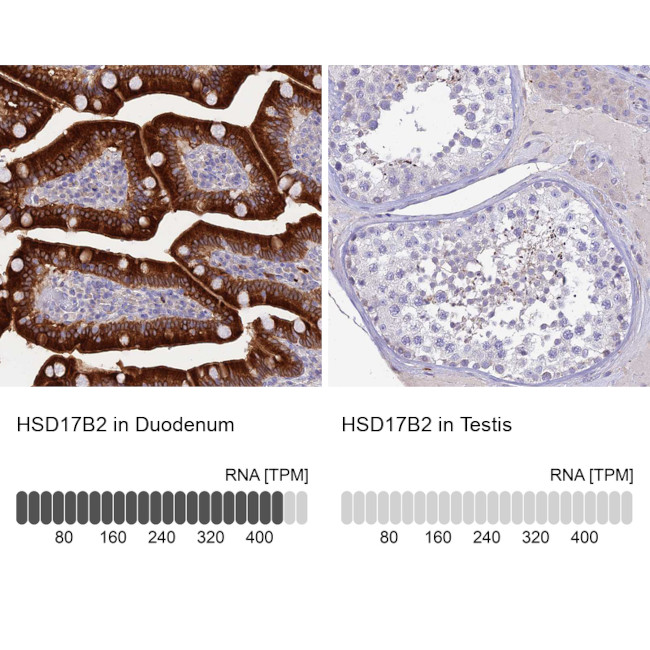 HSD17B2 Antibody in Immunohistochemistry (IHC)
