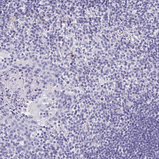 Laminin gamma-3 Antibody in Immunohistochemistry (IHC)