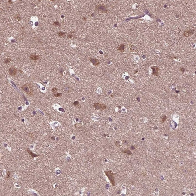 RIPX Antibody in Immunohistochemistry (IHC)