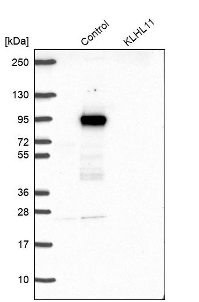 KLHL11 Antibody in Western Blot (WB)