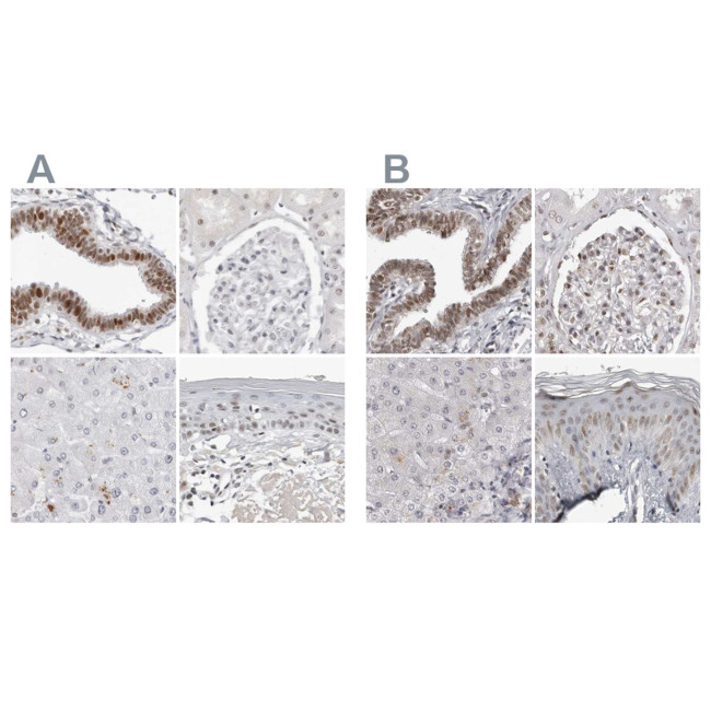 WRAP53 Antibody in Immunohistochemistry (IHC)