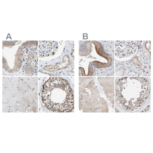 SLC38A10 Antibody in Immunohistochemistry (IHC)