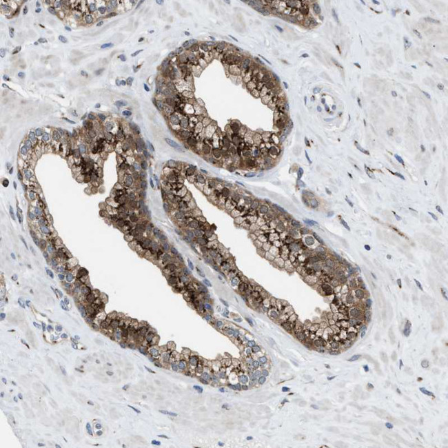 SLC38A10 Antibody in Immunohistochemistry (IHC)