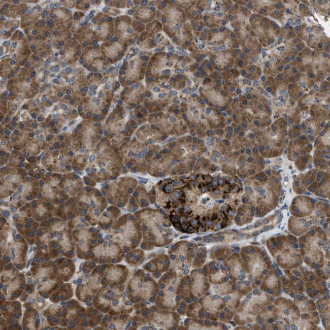 SLC38A10 Antibody in Immunohistochemistry (IHC)