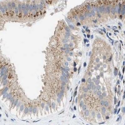 SLC38A10 Antibody in Immunohistochemistry (IHC)