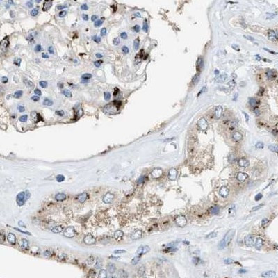 SLC38A10 Antibody in Immunohistochemistry (IHC)