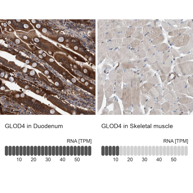 C17orf25 Antibody in Immunohistochemistry (IHC)