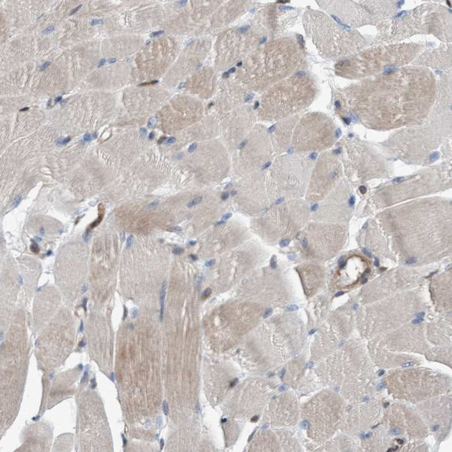 C17orf25 Antibody in Immunohistochemistry (IHC)