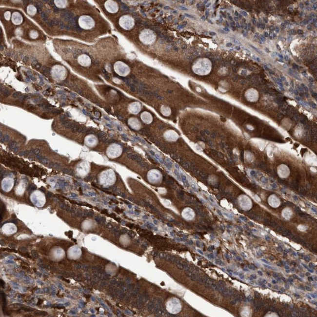 C17orf25 Antibody in Immunohistochemistry (IHC)