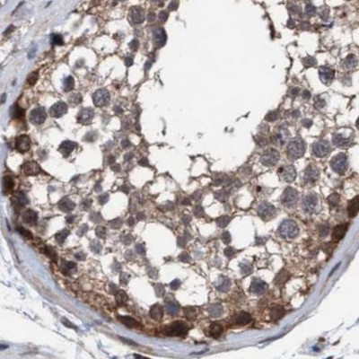 C17orf25 Antibody in Immunohistochemistry (IHC)