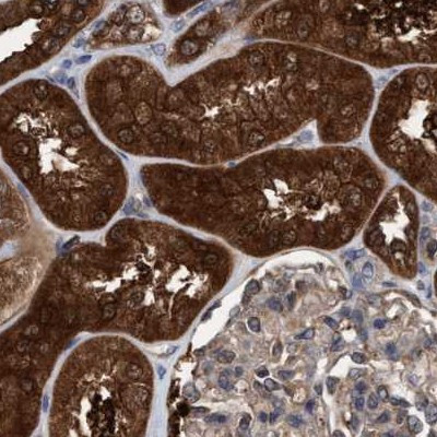 C17orf25 Antibody in Immunohistochemistry (IHC)