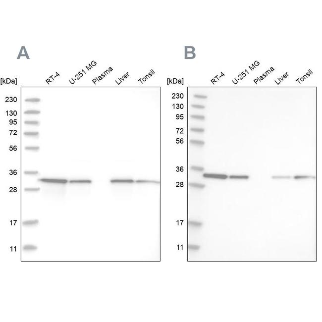 C17orf25 Antibody in Western Blot (WB)